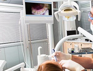 Intraoral photos on computer monitor