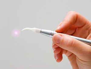 Hand holding a dental laser