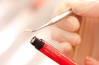 A dental professional using a tool to remove composite resin from tube