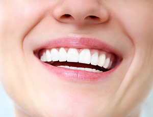 Closeup of beautiful smile after dental bonding