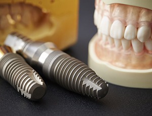 dental implants lying on a table next to a set of dentures 