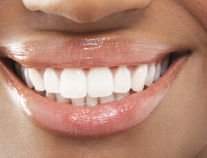 A person’s teeth in Plano