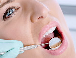 Closeup of patient receiving oral cancer screening
