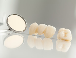 Dental crown and fixed bridge