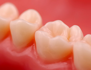 Closeup of smile with tooth colored fillings