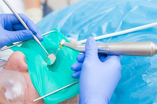 A patient having a root canal performed