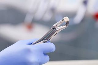 dentist holding an extracted tooth