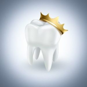 Picture of a tooth with a royal crown