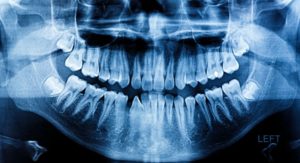 A panoramic dental X-ray.