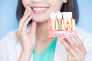 woman holding dental implants in Plano