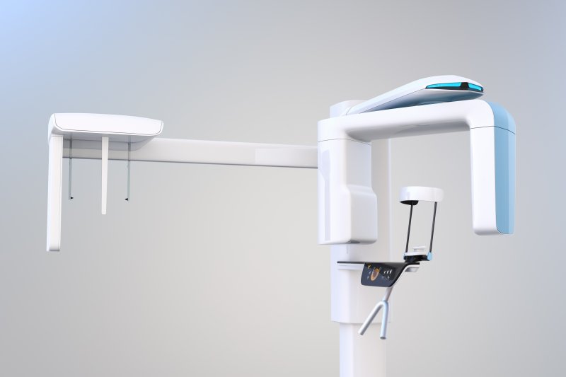 example of a cone beam scanner in Plano